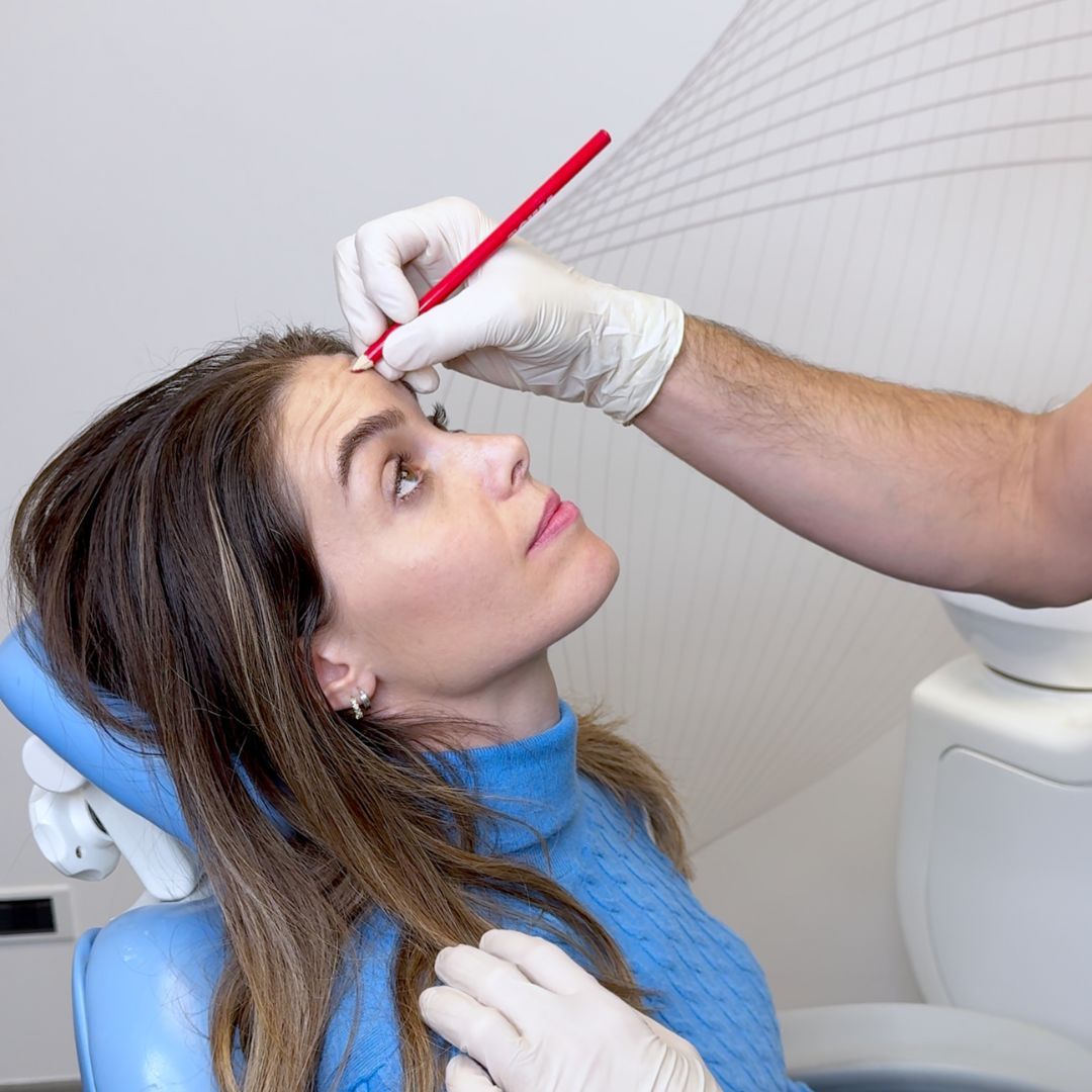 Filler Labbra a Cento - - Dentista a Finale Emilia - Dentista a San Pietro in Casale - Dentista a San Giovanni in Persiceto