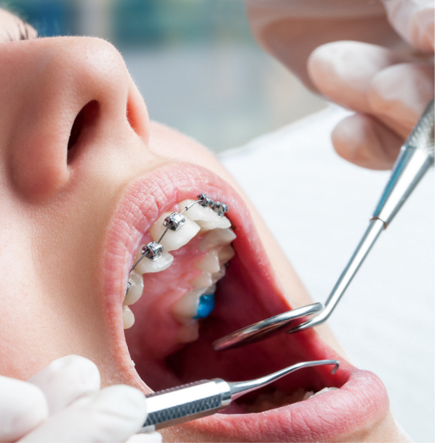Ortodonzia | Servizi | Studio Dentistico Banzi a Pieve di Cento (BO)