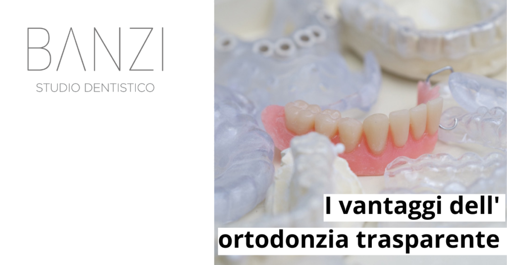 I vantaggi dellortodonzia trasparente | Studio Dentistico a Pieve di Cento | Studio Dentistico Banzi
