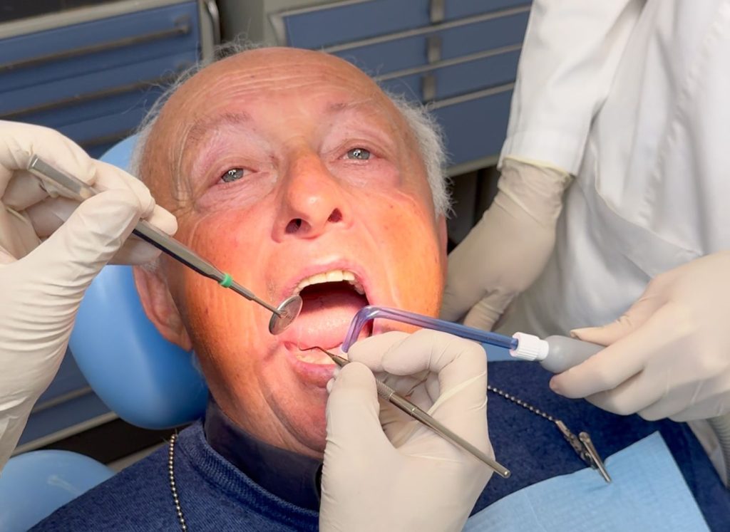 Impianto dentale come funziona: guida completa 1 impianto dentale