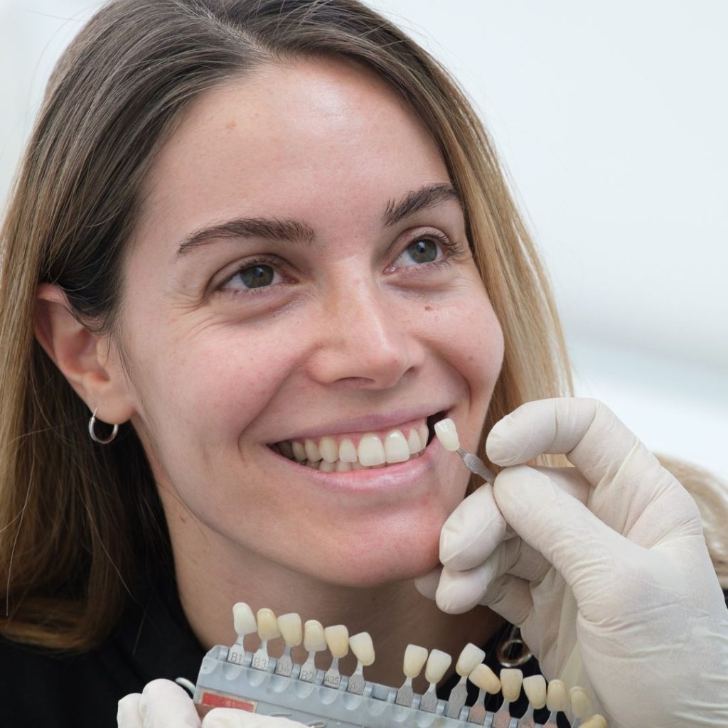 Faccette Dentali 1 Faccette dentali a Cento