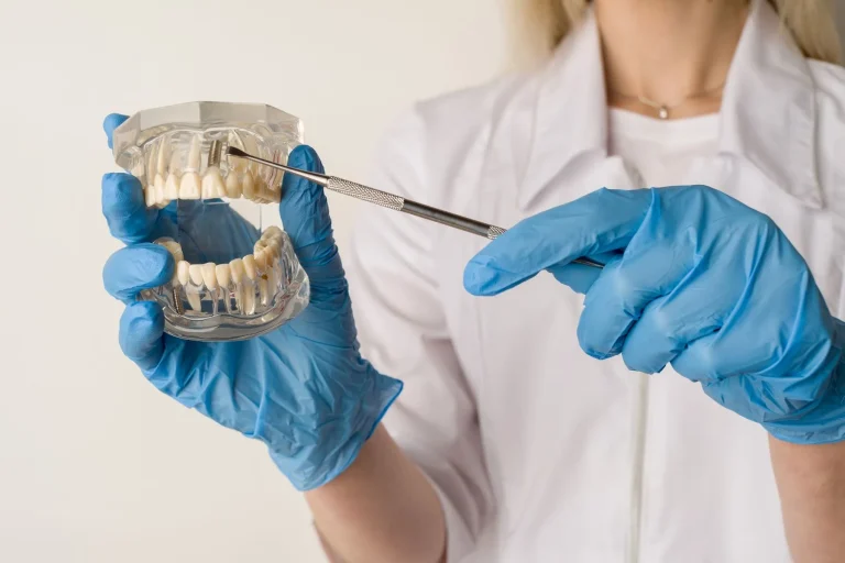 implantologia dentale
