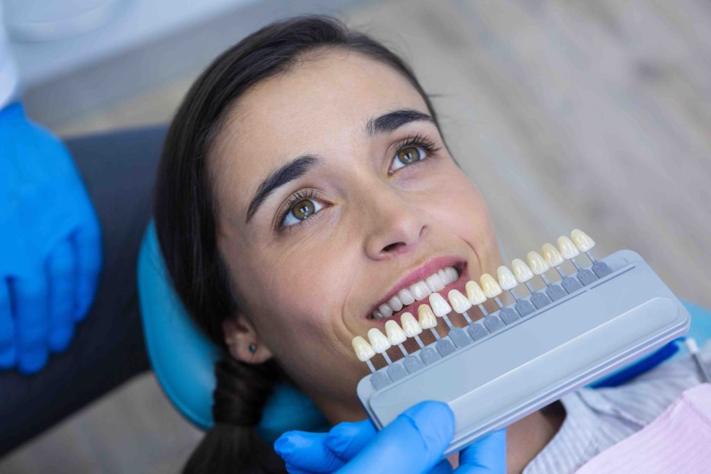 Scegliere il colore delle faccette: come ottenere un sorriso naturale 1 scegliere il colore delle faccette
