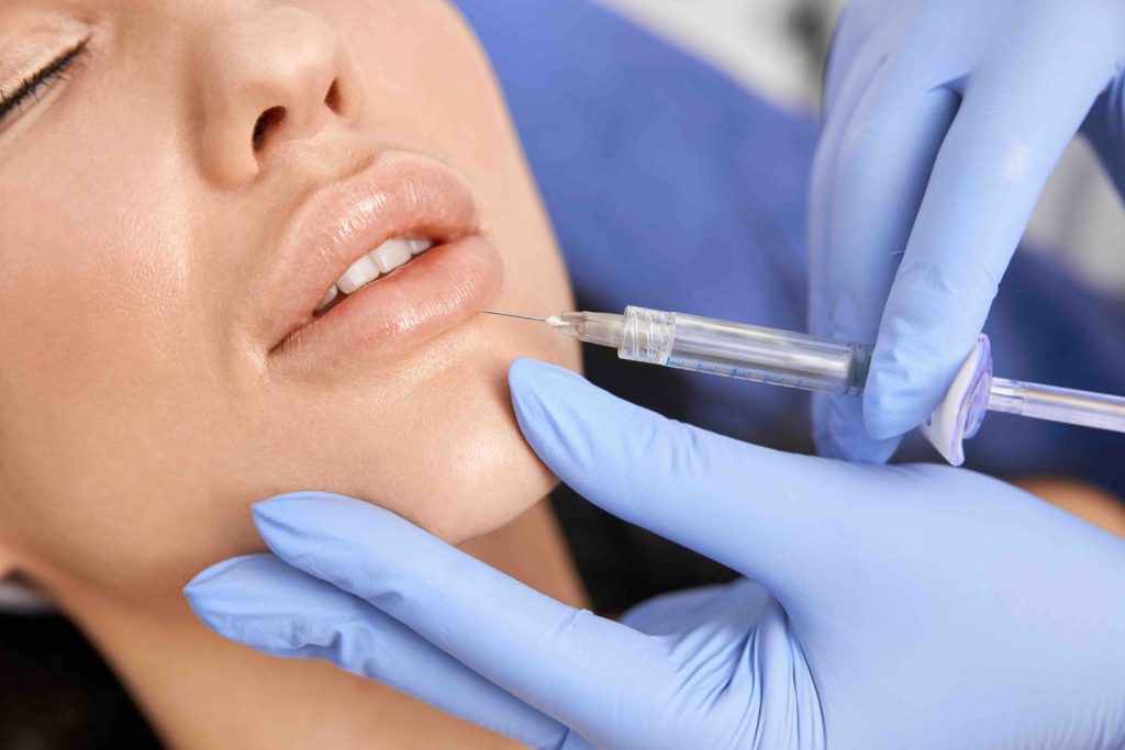 La guida completa al filler labbra 1 Filler labbra