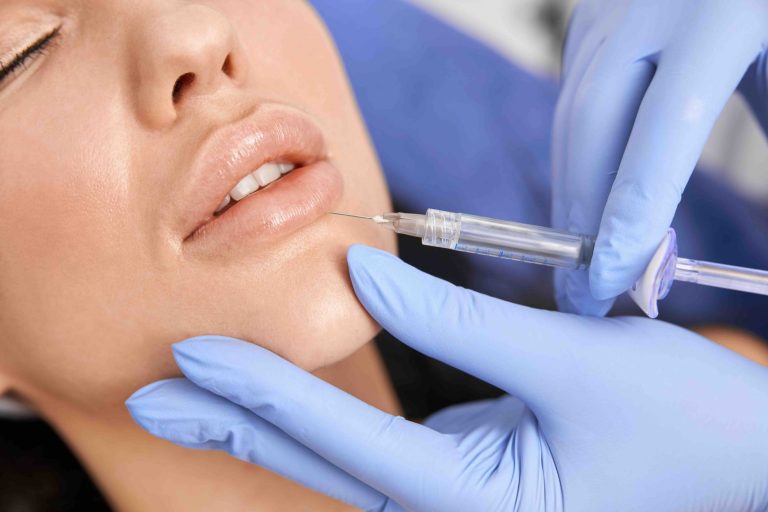 Filler labbra Filler labbra